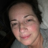 Sunshine from Denham Springs | Woman | 62 years old | Cancer
