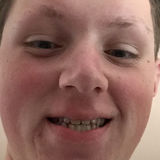 Bn from Middletown | Man | 29 years old | Cancer