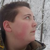 Shelly from Pikeville | Woman | 28 years old | Cancer